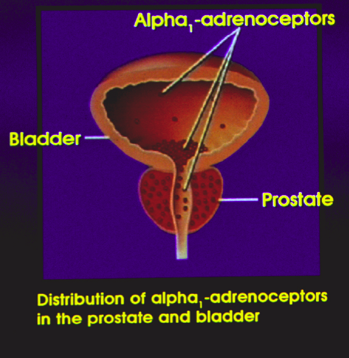 Alternative Therapies and Natural Remedies: Bladder ...