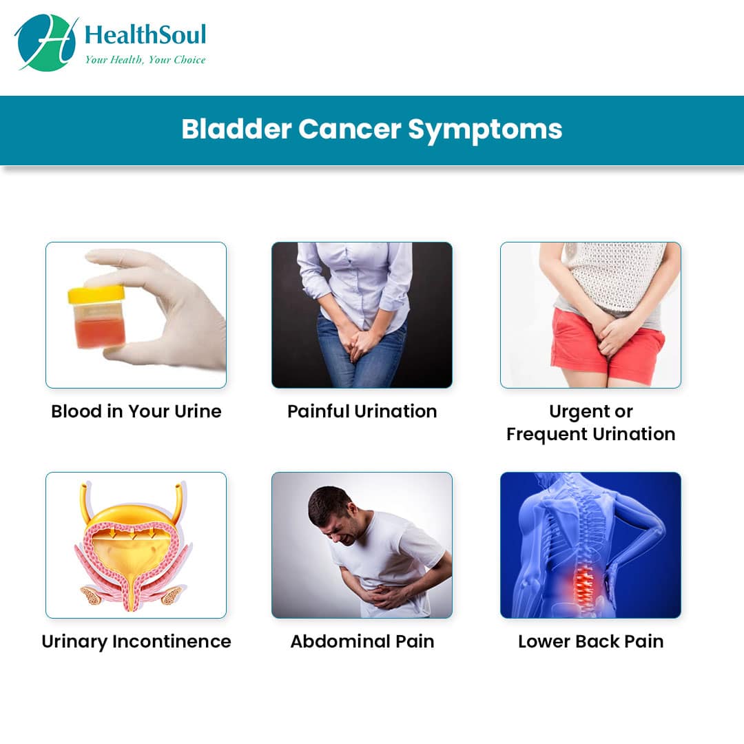 Does Bladder Cancer Cause Back Pain