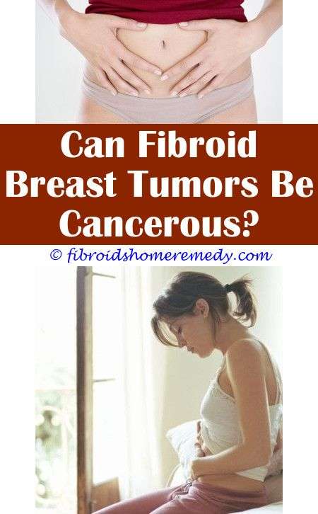 Fibroid Tumor Pressing On Bladder (With images)