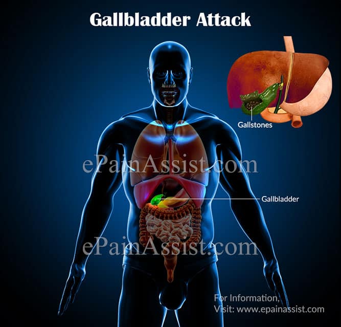 Gallbladder Attack