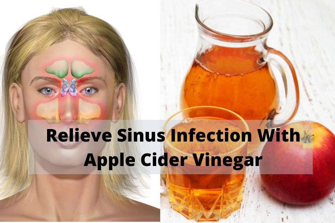 How To Relieve Sinus Infection With Apple Cider Vinegar ...