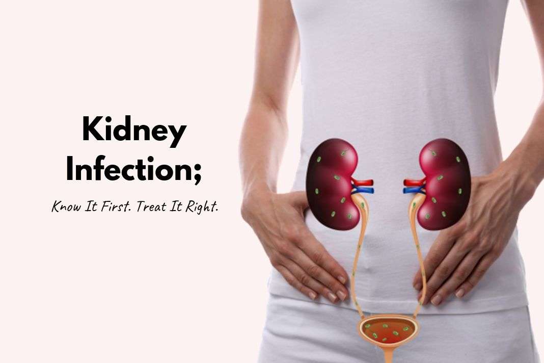 How To Treat Kidney Infection With Natural Remedies?