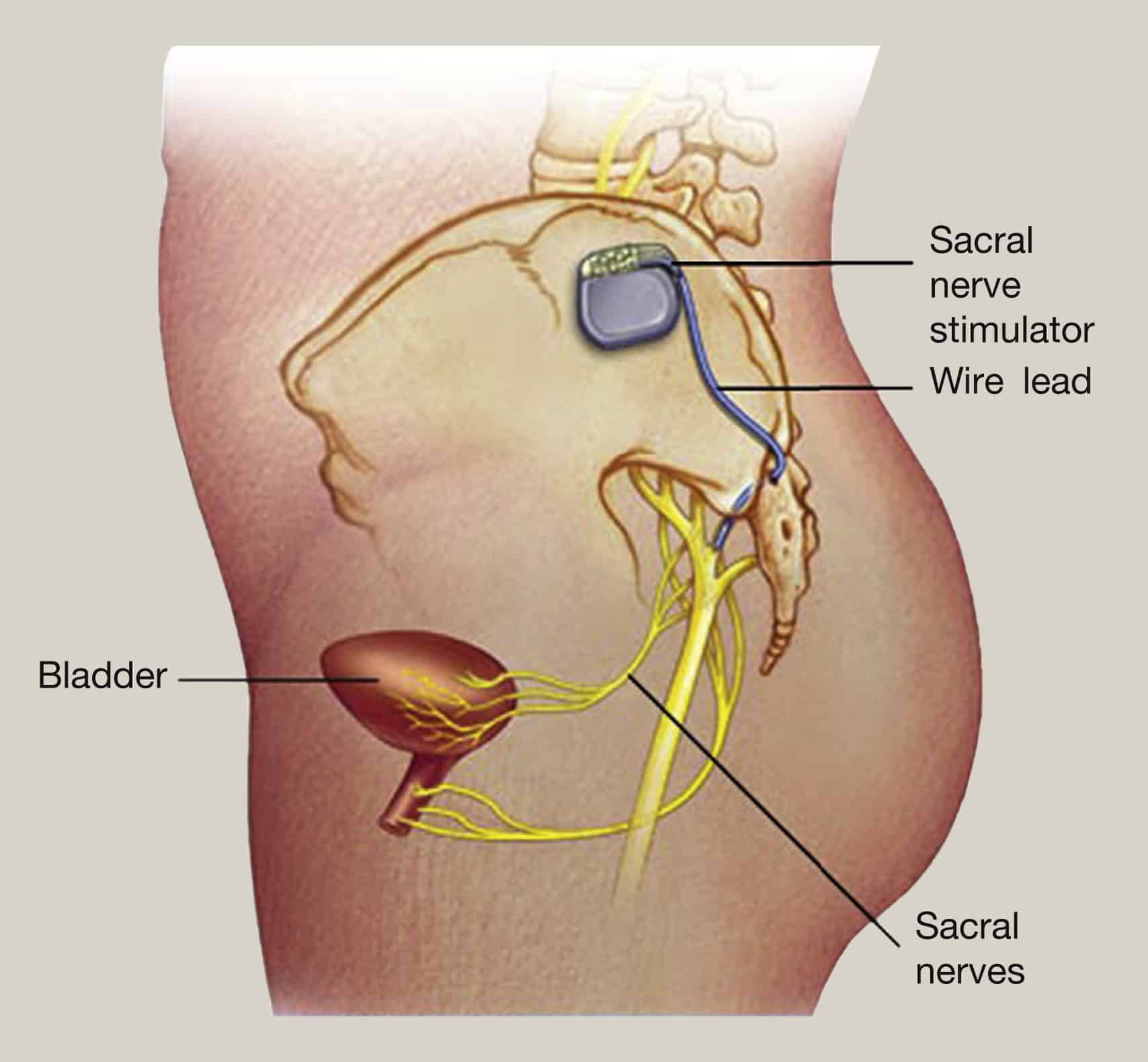 Modern management of overactive bladder syndrome