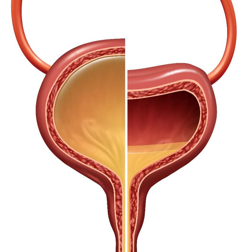 Overactive Bladder Symptoms, Causes, Diagnosis &  Treatment