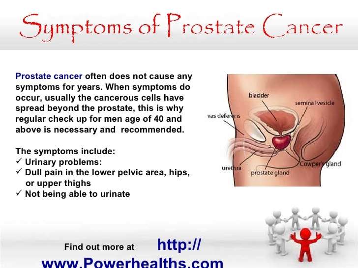 Symptoms Of Prostate Cancer