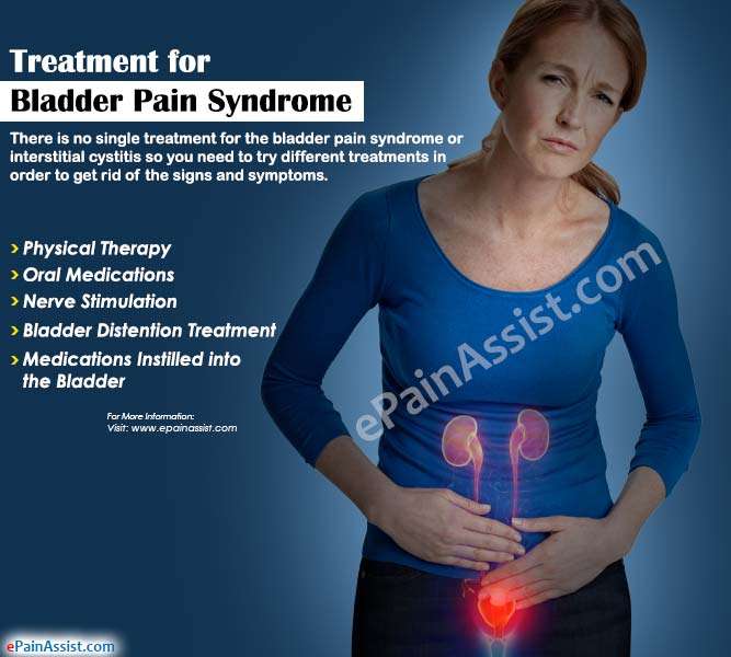 Treatment for Bladder Pain Syndrome or Interstitial ...