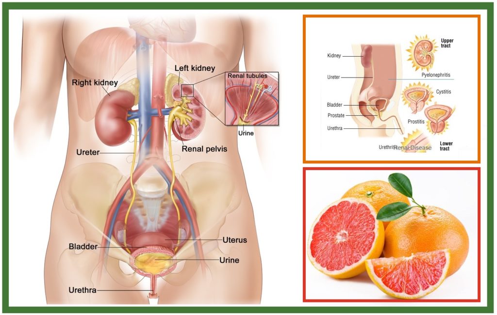 Urinary Tract Infection: Symptoms, Causes and Prevention