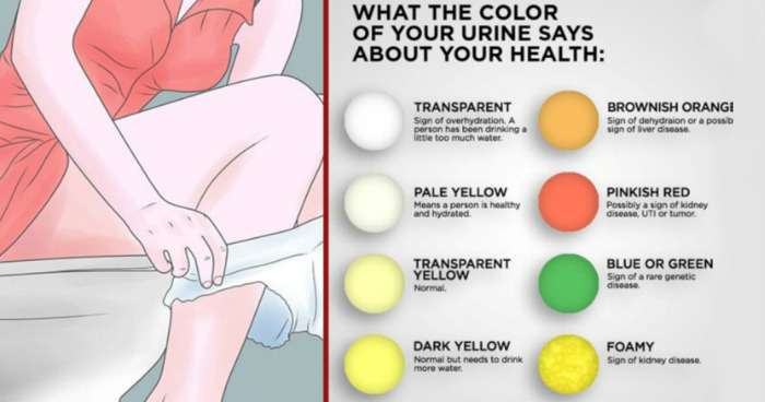 What Does The Color Of Your Urine Say About Your Health