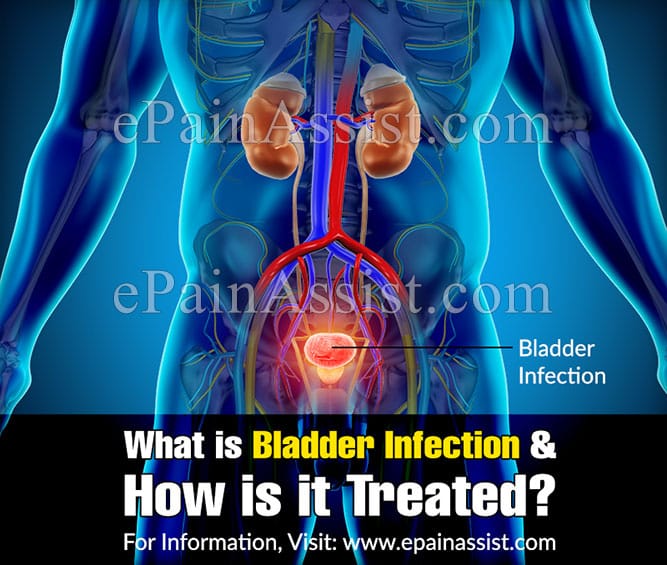 What is Bladder Infection &  How is it Treated?