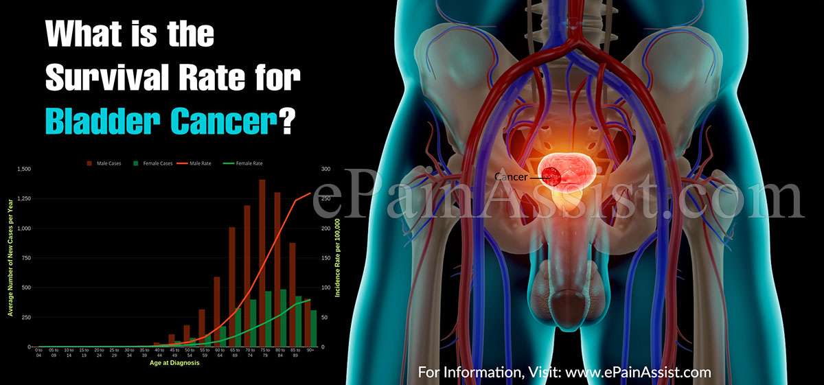 What is the Survival Rate for Bladder Cancer?